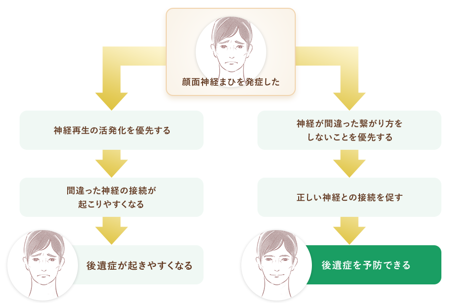 顔面神経まひの後遺症を予防する初期アプローチ