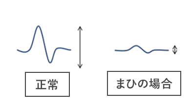 損傷の割合を示すグラフ